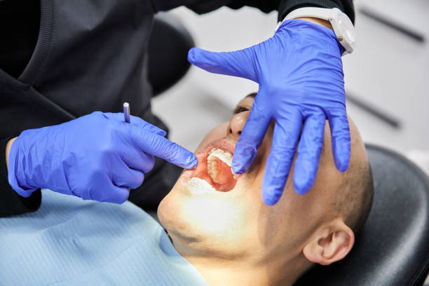Best Teeth Whitening  in Kersey, CO